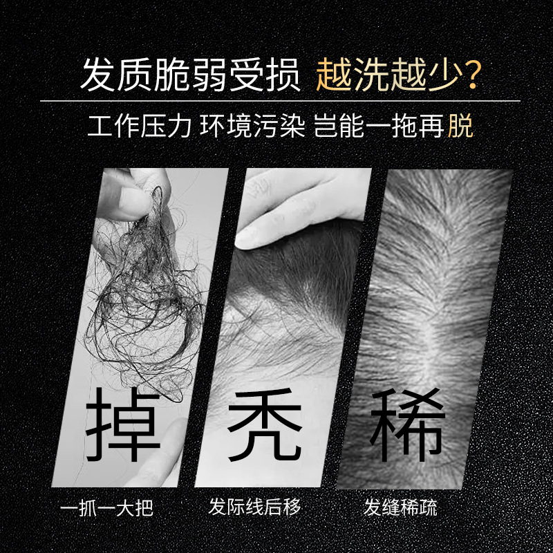 Famulan Anti Hair Loss Shampoo - Hair Care Normal review and price