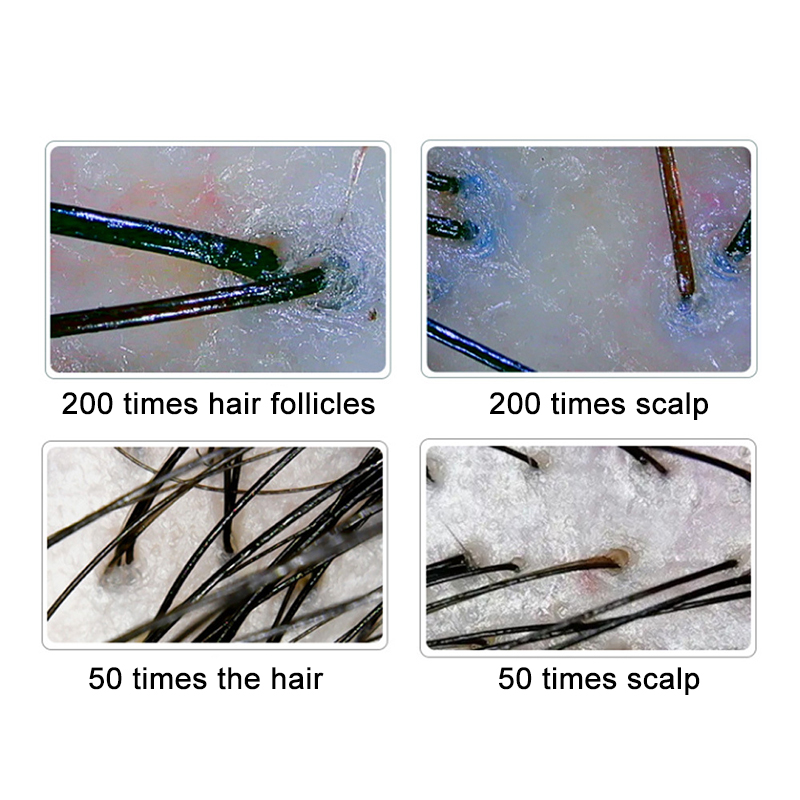 200/50X Skin Hair Scalp Detect - Hair Porosity Test review and price