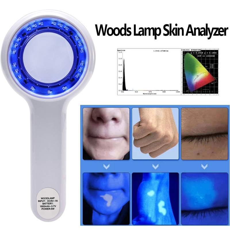 NEW Woods Lamp Skin Analyzer P - Hair Porosity Test review and price