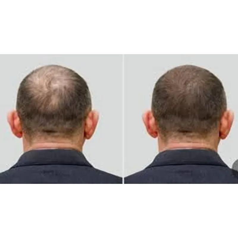 Good Seal Ozone Cap Ozone Hat  - Hair Care Good Hair review and price