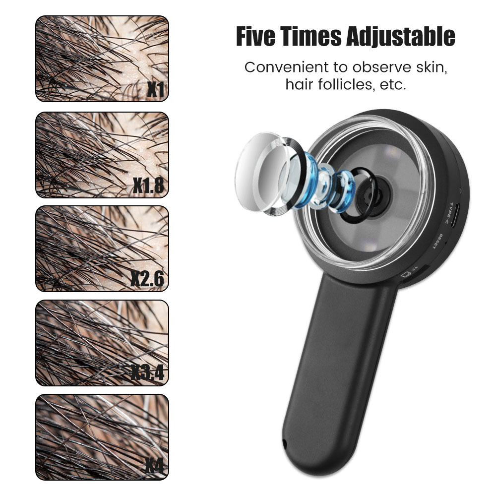 Handheld Dermatoscope,100X Mag - Hair Porosity Test review and price