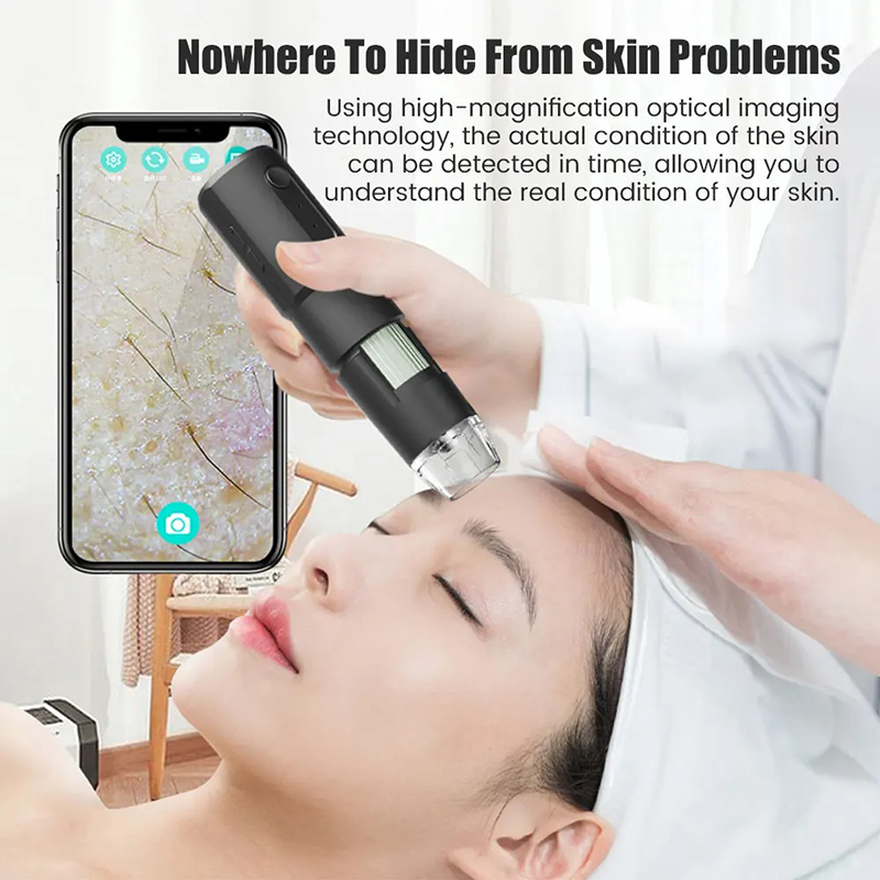 Wireless Dermatoscope Scalp Sk - Hair Porosity Test review and price